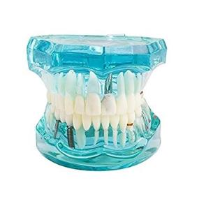 img 2 attached to Angzhili прозрачная модель для восстановления зубов для взрослых со съемным зубом - стандартный обучающий инструмент для стоматолога для студентов (1 шт.)