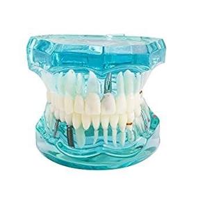 img 1 attached to Angzhili прозрачная модель для восстановления зубов для взрослых со съемным зубом - стандартный обучающий инструмент для стоматолога для студентов (1 шт.)