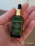 img 1 attached to 🌿 Clear Severe Acne with BREYLEE Tea Tree Clear Skin Serum – Pimple Remover & Skin Repair review by Ron Kishore