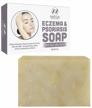 eczema soap bar for face and body – all natural dermatitis, psoriasis treatment for dry itchy flaky skin relief – gentle detoxifying, healing, anti-itch, cleansing skincare remedy – 4 oz eczema soap bar made in usa logo