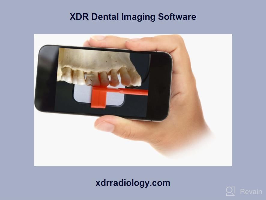 img 1 attached to XDR Dental Imaging Software review by Christopher Todd