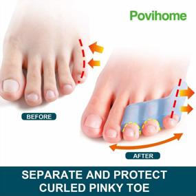 img 2 attached to Povihome 10 Pack Pinky Toe Separator And Protectors, Toe Separators For Overlapping Toe, Curled Pinky Toes Separate And Protect - Spacers For Morton'S Neuroma Pain Relief