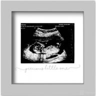 🤰 capture the miracle of life with our modern ultrasound frame - perfect for expecting parents, pregnancy announcements, and first-time dad gifts! logo