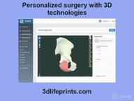 картинка 1 прикреплена к отзыву 3D LifePrints Design & Segmentation от Robert Rasmussen