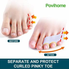 img 2 attached to Povihome 10 Pack Pinky Toe Separator And Protectors, Triple Gel Toe Separators For Overlapping Toe, Curled Pinky Toes Separate And Protect