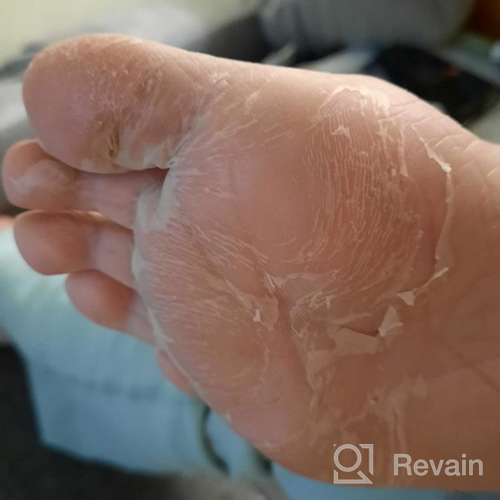 img 1 attached to Get Baby Soft Feet With Plantifique'S 4-Pc Family Pack Foot Peel Mask - Dermatologically Tested For Peeling, Repairing Heels & Removing Dead Skin - Exfoliating Solution For Dry Cracked Feet review by Julie Gomez