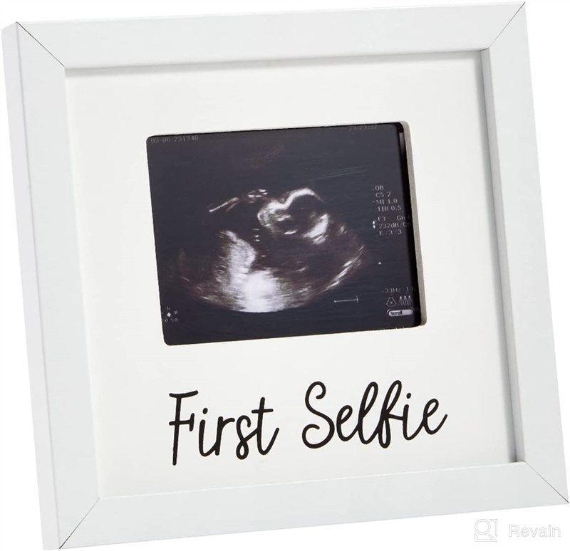 Sonogram Picture Frame Ultrasound Selfie Reviews & Ratings | Revain