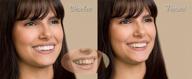 💁 imako cosmetic teeth 1 pack: large, natural uppers only for diy smile makeover – easy fit at home! logo
