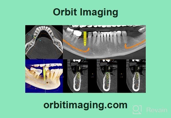 img 1 attached to Orbit Imaging review by Andrew Woodruff