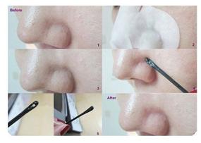 img 1 attached to 🎭 Ciracle Blackhead Off Cotton Mask: Effective Black Dots Remover - 5 ml, 20 pcs.
