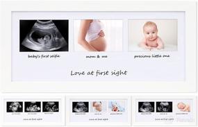 img 4 attached to 👶 Love at First Sight Triple Sonogram Picture Frame, Baby Ultrasound Keepsake Frame Nursery Decor Gender Reveal Gifts for First Time Moms Expecting Parents, White
