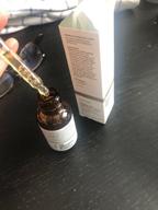 img 1 attached to 👁️ The Ordinary Caffeine Solution: Reduces Eye Contour Pigmentation and Puffiness (30ml) review by Ada Aleksandrowska ᠌
