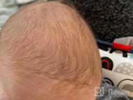 img 1 attached to Fridababy'S Dermatologist-Recommended 3-Step Cradle Cap System: FlakeFixer Sponge, Brush, Comb And Storage Stand For Baby'S Pristine Skin review by Luis Estrella