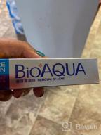 img 1 attached to BIOAQUA Face Skin Care Acne Anti-Wrinkle Removal Cream Spots Scar Blemish Marks 30G review by Damon Mertz