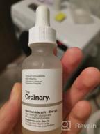 img 1 attached to 💧 The Ordinary 100% Plant-Derived Squalane, Niacinamide 10% + Zinc 1%, Hyaluronic Acid 2% + B5 Face Serum Set for Optimum Hydration and Blemish Reduction review by Agata Kulesza ᠌