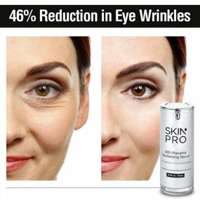 img 3 attached to SkinPro BIO-Placenta Revitalizing Serum - With Argireline - Reduce Eye Wrinkles, Skin Regeneration, Collagen Products, Wrinkle Treatment - Anti Aging Face Serum