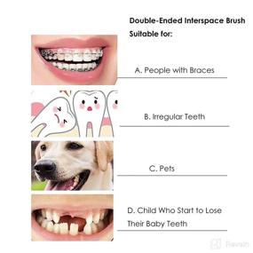 img 1 attached to Orthodontic Toothbrush Double Ended Interspace Cleaning Oral Care : Toothbrushes & Accessories