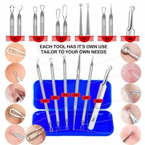 img 1 attached to 6-Piece Blackhead Remover Tool Kit For Extracting Acne, Whiteheads, Pimples, Zits & Clogged Pores - Includes Organized Storage Case.
