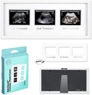 babysquad trimester ultrasound progression babyshower logo
