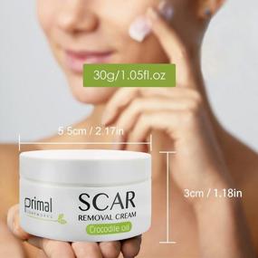 img 3 attached to Say Goodbye To Scars With Premium Acne Scar Treatment Cream - Scar Away Face Skin Repair Cream For Men & Women