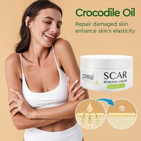 img 2 attached to Say Goodbye To Scars With Premium Acne Scar Treatment Cream - Scar Away Face Skin Repair Cream For Men & Women