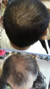 img 2 attached to Rene Furterer Реактивное средство для истончения волос при внезапном выпадении волос - раствор без лекарств (1 штука)
