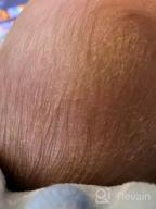 картинка 1 прикреплена к отзыву Fridababy'S Dermatologist-Recommended 3-Step Cradle Cap System: FlakeFixer Sponge, Brush, Comb And Storage Stand For Baby'S Pristine Skin от Noel Schmits