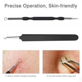 img 1 attached to Z-Blackhead Remover And Acne Extraction Kit By JPNK For Effective Comedone Removal