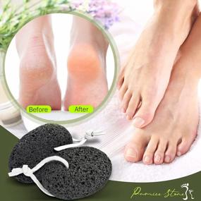 img 3 attached to Pamper Your Feet With Natural Pumice Stone - Best Callus Remover To Exfoliate And Rejuvenate Feet And Hands!