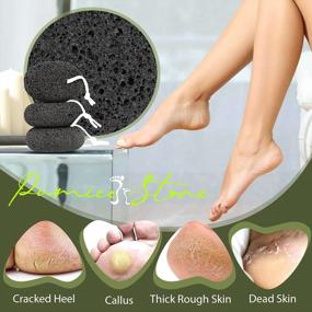 img 2 attached to Pamper Your Feet With Natural Pumice Stone - Best Callus Remover To Exfoliate And Rejuvenate Feet And Hands!
