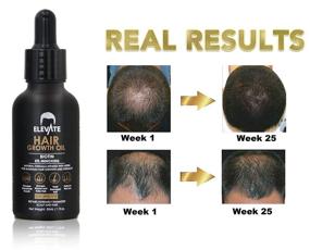 img 2 attached to ELEVATE Hair Growth Oil Thickening