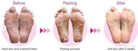 img 1 attached to 1000Hour Softsole Express Exfoliating Calluses