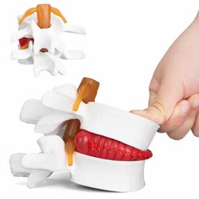 img 4 attached to Transform Your Study Experience With ANNWAN'S Lumbar Disc Herniation Model - A Revolutionary Tool For Anatomy Learning And Teaching