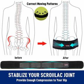 img 1 attached to Featol Sacroiliac Hip Belt For Women And Men - Si Joint Brace Alleviating Sciatic, Pelvic, Lower Back, Leg, And Sacral Nerve Pain, Stabilizing Trochanter Belt (Medium)