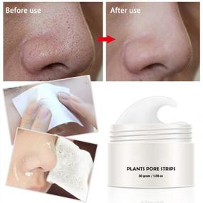 img 3 attached to Get Clear And Radiant Skin With Ofanyia'S Deep Cleansing Nose Blackhead Remover Mask - Acne Treatment And Pore Strips