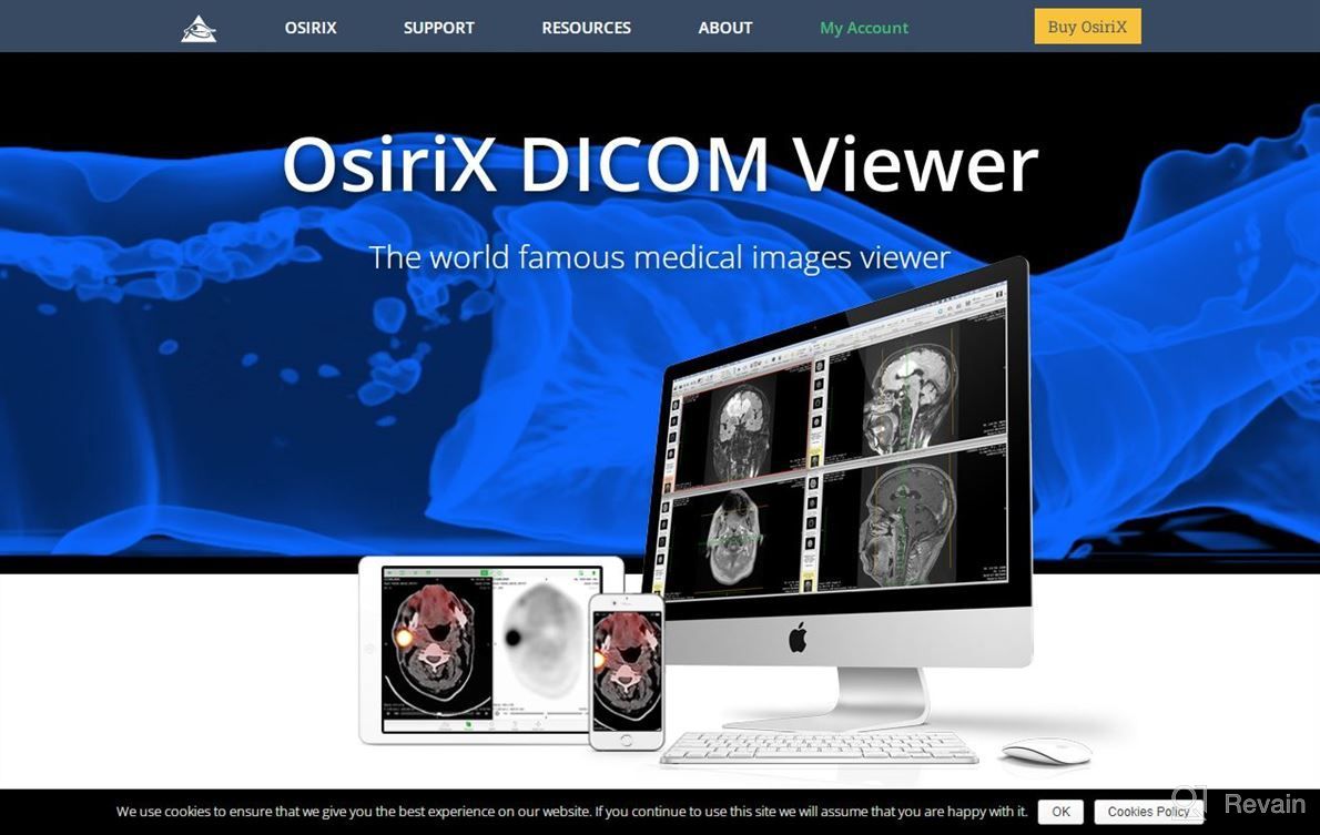 img 1 attached to OsiriX MD review by Frank Nguyen