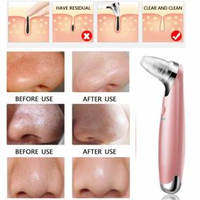 img 2 attached to Pink Electric Blackhead Remover Vacuum With 5-Speed Adjustability And 5 Suction Heads, Beauty Lamp Treatment For Facial Skin - Perfect Blackhead Remover Tool