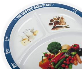 img 3 attached to Revolutionize Portion Control for Weight Management with Gastric Plate