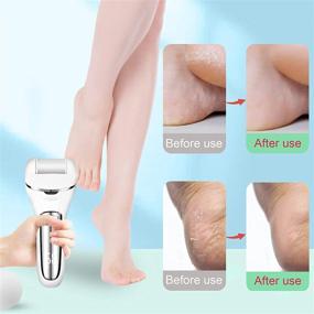 img 2 attached to Electric Foot Callus Remover - Powerful Dead Skin Remover for Feet, with 3 Roller Heads and 2 Speeds - Pedicure Tools for Effective Foot Care