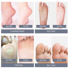 img 3 attached to 👣 Get Baby Smooth Feet with Mixbeauty Foot Peel Mask - 2 Pack! Remove Dead Skin, Cracked Heels & Calluses, Natural & Painless Exfoliating Foot Masks for Men & Women (Up to Size 12)