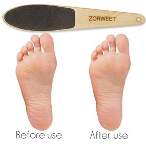 img 1 attached to ZORWEET Pedicure Remover Colossal Scrubber