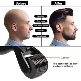 img 3 attached to Complete Beard Growth Kit - Derma Roller for Enhanced Beard Growth, Nourishing Beard Growth Serum (2oz), Multipurpose Beard Balm and Comb Set, Boost Beard and Hair Growth - Perfect Gifts for Men, Dad, Him, Boyfriend, Husband, Brother