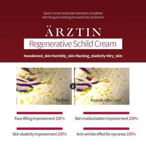 img 2 attached to 🧴 Regenerative Schild Cream: Dermatologist-Recommended Daily Repair for Sensitive & Anti-Aging Care (1.8 oz)