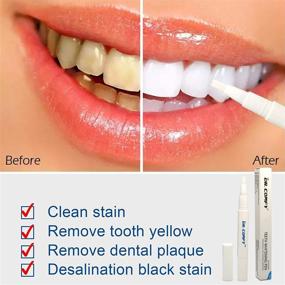 img 3 attached to 🦷 Years of Stain Removal with Teeth Whitening Pen – Safe, Effective, Hygienic Oral Care for Beautiful White Smile - 1 Pcs