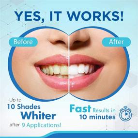 img 3 attached to MySmile Teeth Whitening Kit: Fast & Effective 10 Min Whitener with LED Light, 3 Non-Sensitive Gel & Tray to Remove Teeth Stains from Coffee, Drinks & Food