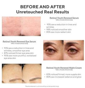 img 2 attached to Murad Youth Renewal Retinol Trial