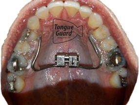 img 3 attached to RPE Tongue Guard Prevents Expanders