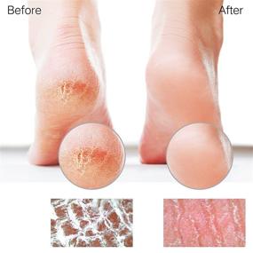 img 1 attached to 👣 Sunivaca Glass Foot File: Versatile Dead Skin Remover for Smooth and Radiant Feet