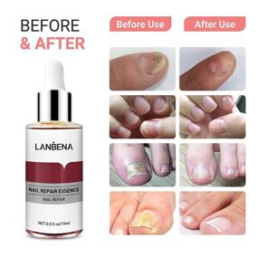 img 2 attached to 💅 LANBENA Эссенция для восстановления ногтей: Эффективное лечение для поврежденных ногтей, восстановление и защита от инфекции, изменения окраски и повреждений (12 мл)