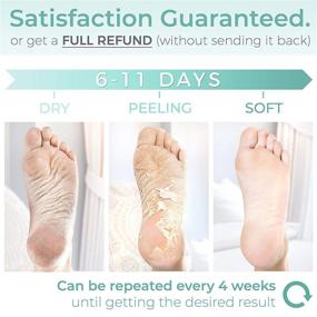 img 1 attached to 👣 Foot Peel Mask - Pack of 4 - Treat Cracked Heels, Calluses and Dead Skin - Soften and Smooth Your Feet for Silky, Baby-Soft Skin - Natural Treatment to Remove Rough Heels and Dry Toe Skin (Strawberry Scent)